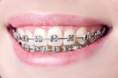 orthodontics-page-2-1024x683